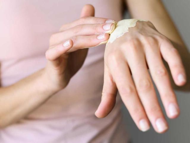 Как да действаме при изгаряне на кожата – първа помощ и възстановяване -Здраве